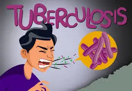 Guide for Prevention, Diagnosis and Treatment of Tuberculosis in Children and Adolescents