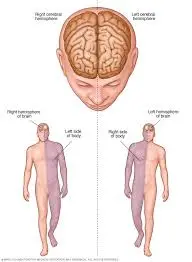 Guidelines for Management of Stroke