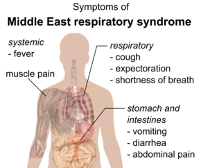 Middle East Treatment for Respiratory Syndrome Coronavirus (MERS-CoV) Infection