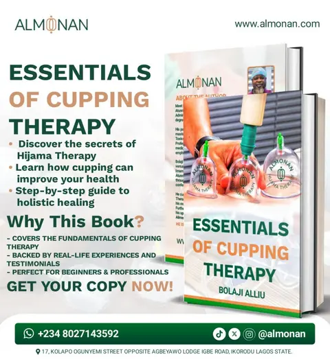 Essentials of Cupping Therapy
